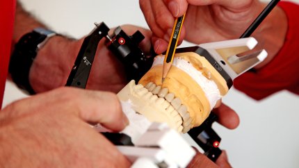 Zannarzt und Dentaltechniker in direkter Zusammenarbeit